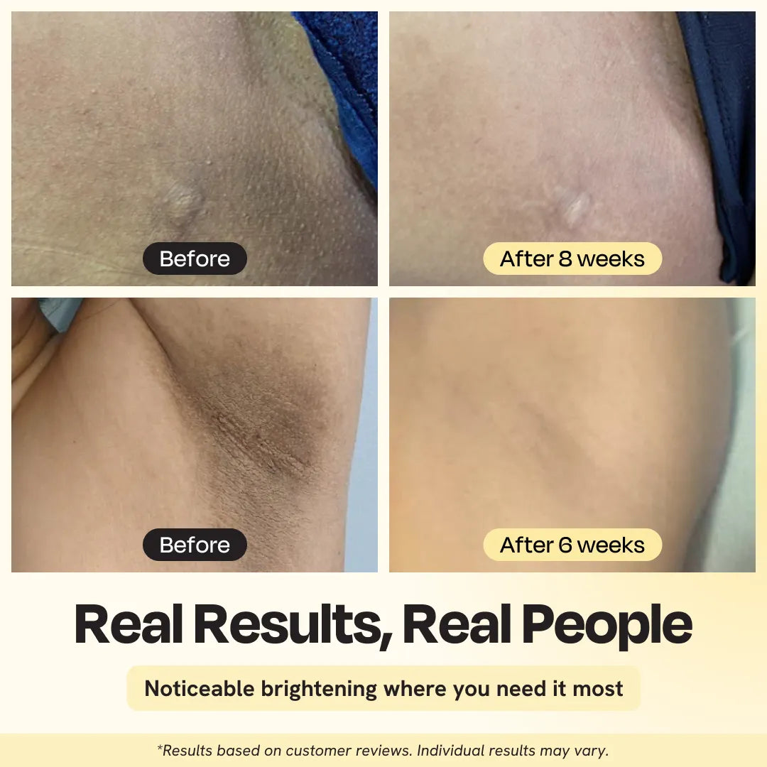 Illuminating Intimate Brightening Serum