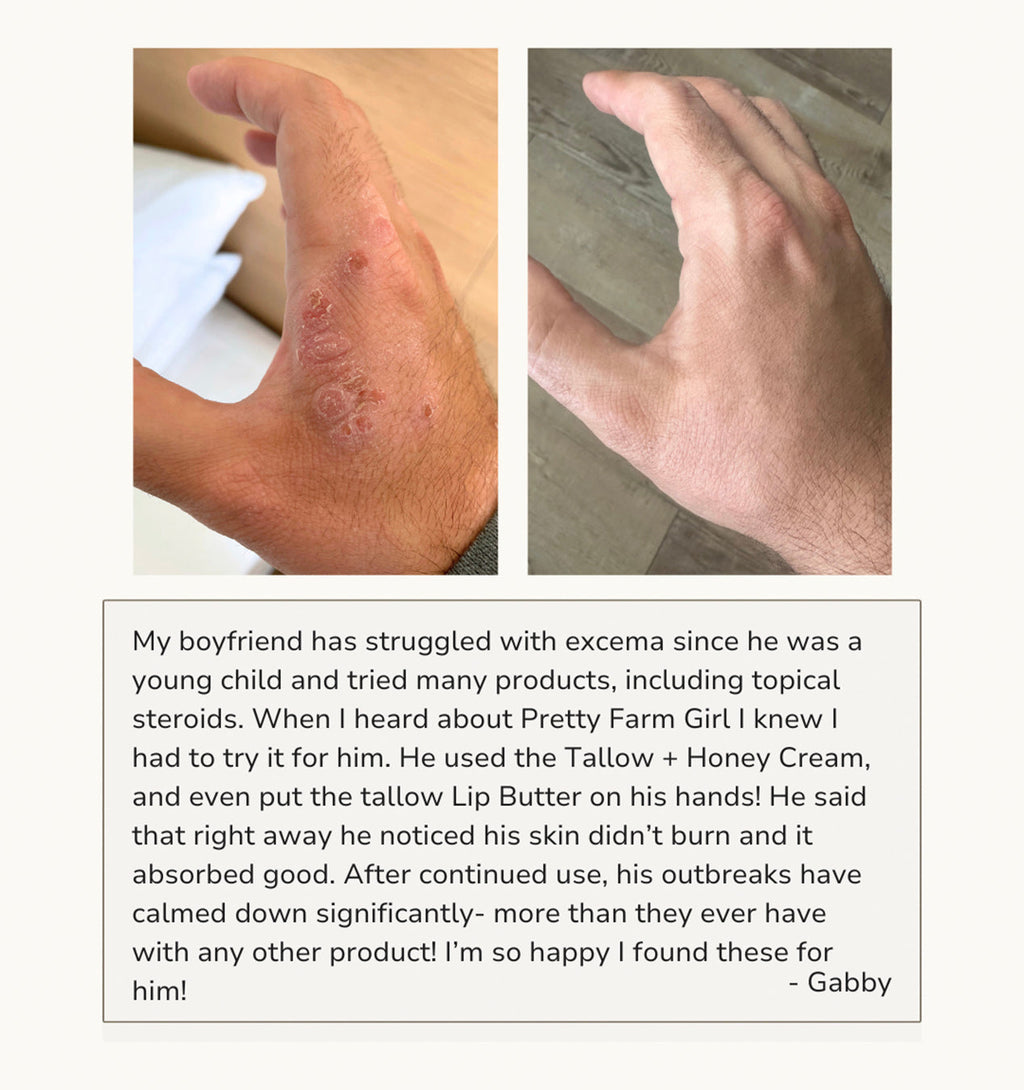 Fragrance-Free Tallow & Honey Moisturizing Cream